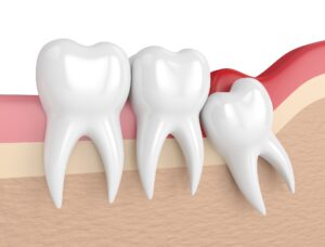 Trafalgar Village Dental – your experienced dentist in Oakville for all dental needs