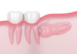 Compassionate family dentist in Oakville offering personalized dental treatments