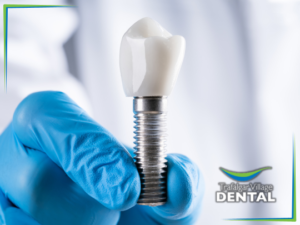 dental implants at trafalgar village dental