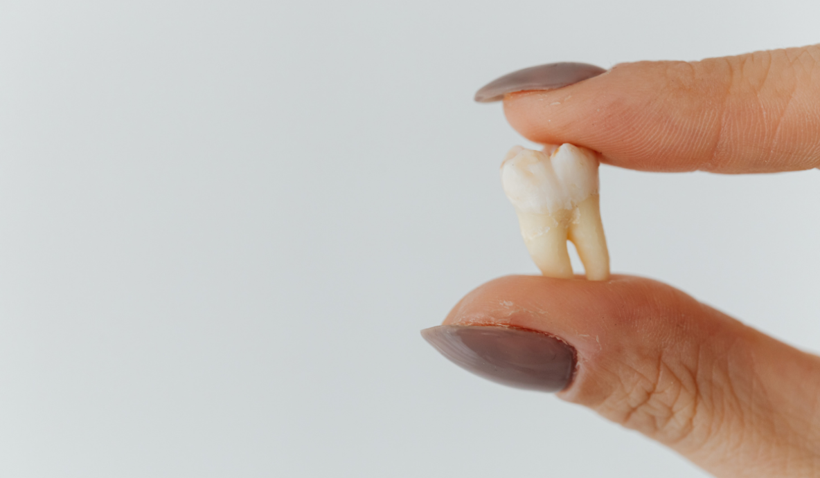 Wisdom teeth extractions post-operative care instructions at Trafalgar Village Dental