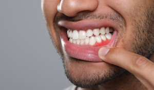 family dentist gum disease treatment at Trafalgar Village Dental