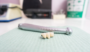 dental implants vs dentures vs bridges comparison at Trafalgar Village Dental Oakville ON